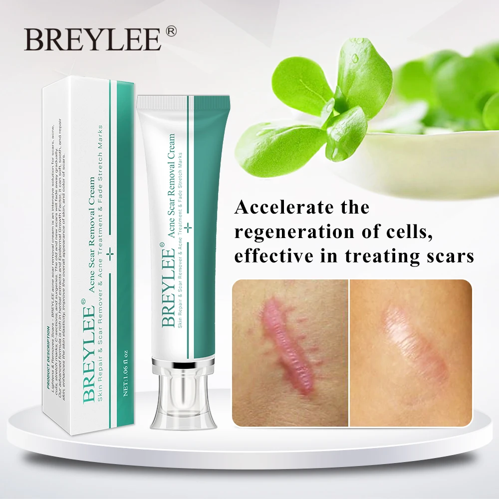 BREYLEE Scar Removal Cream Stretch Marks Removal Acne Scars Skin Repair Whitening Cream Dark Spot Remover For Face Skin Care