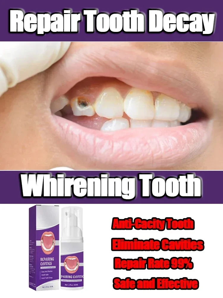 Effective Teeth Whitening Tooth decay repair Calculus Plaque Periodontitis Remove Cavities