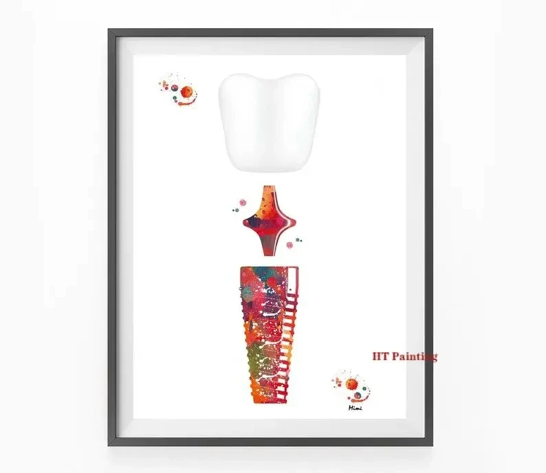 Modern Dental Art - Tooth Implant Anatomy Canvas Poster