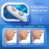 Double Chin Remover Vibration Chin-Up V Face Massager Ems Facial Lifter Beauty Device V-Line Up Face Lift Shaper Belt 2