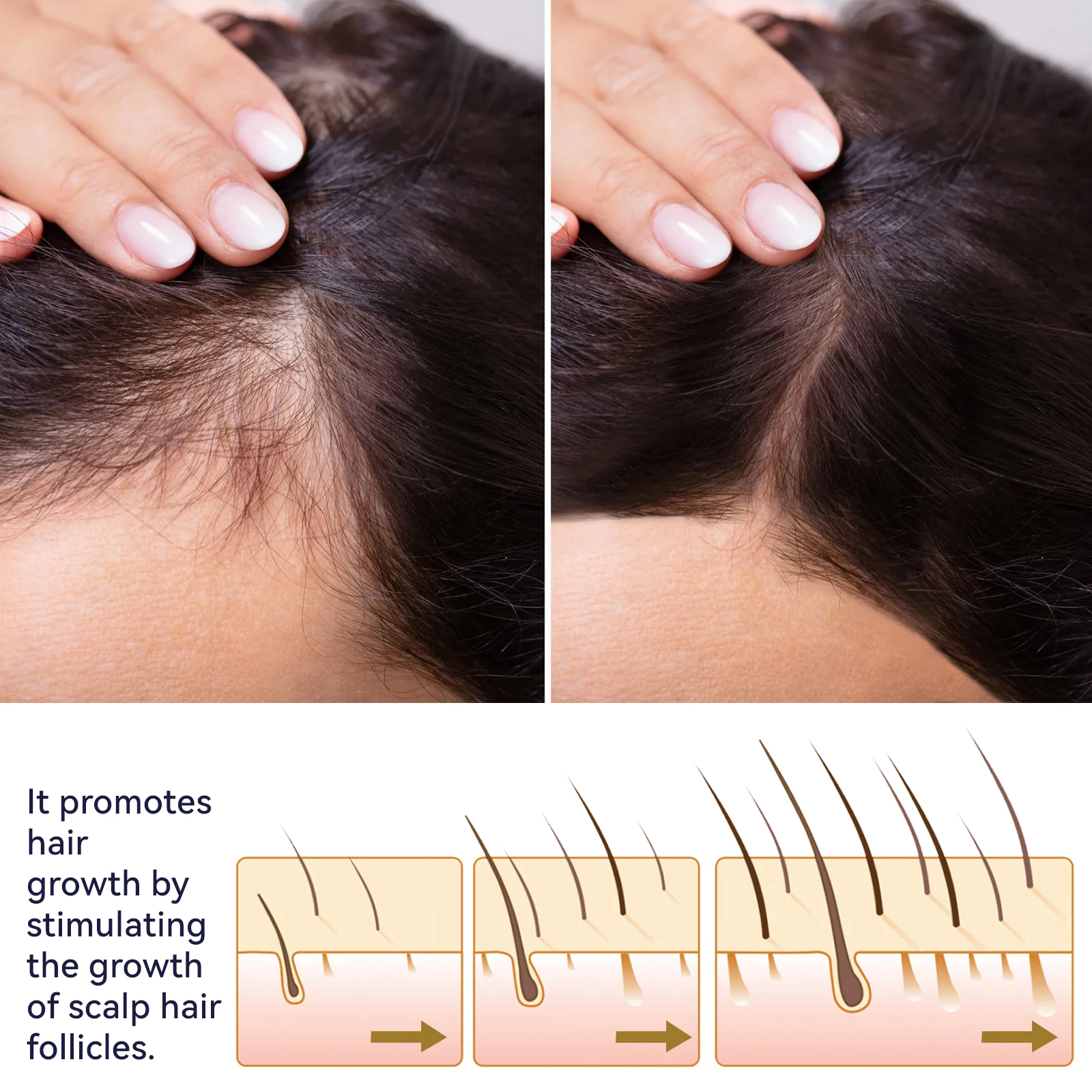 OUHOE Hair Growth Spray Designed To Strengthen Stop Hair Loss Natural Essence Repair & Strengthen Follicles Spray