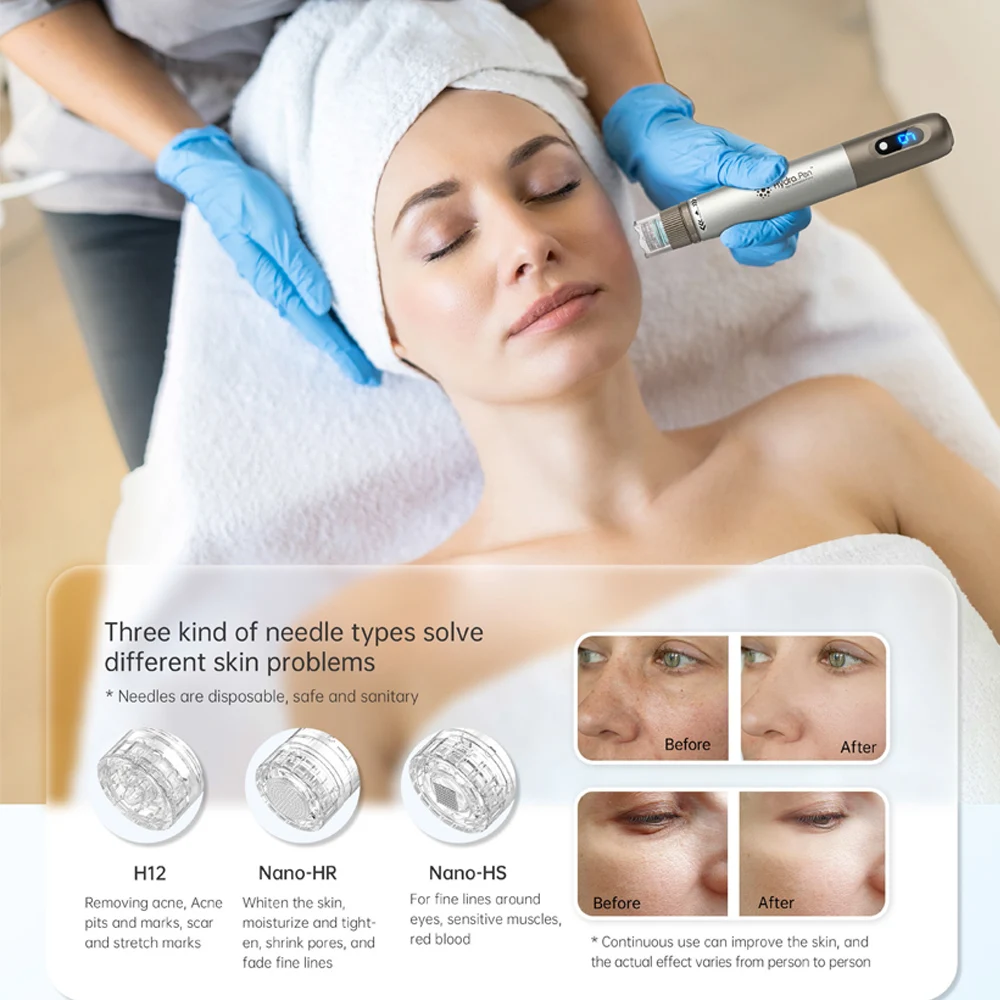 Рисунок 4 - Dr Pen Derma Pen для домашнего использования