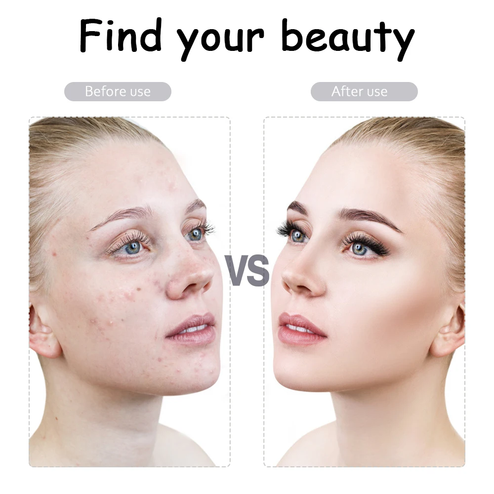 Рисунок 4 - Инструмент для удаления морщин из цинкового сплава