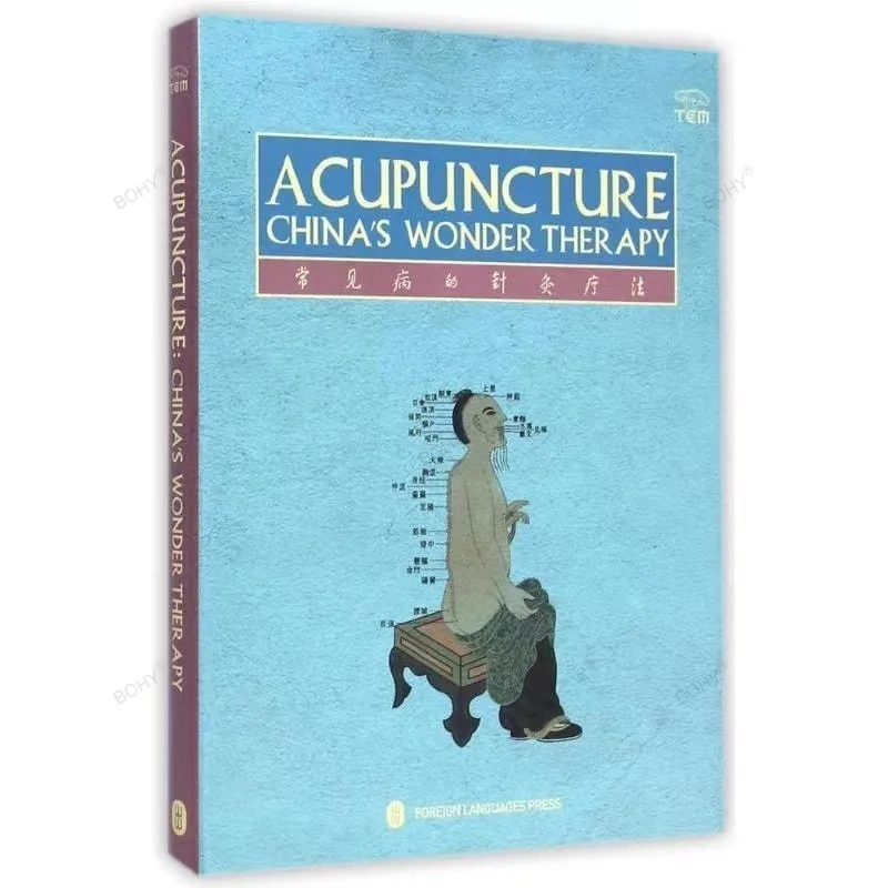 

Acupuncture China's Wonder Therapy Chinese Medicine Acupuncture Book in English