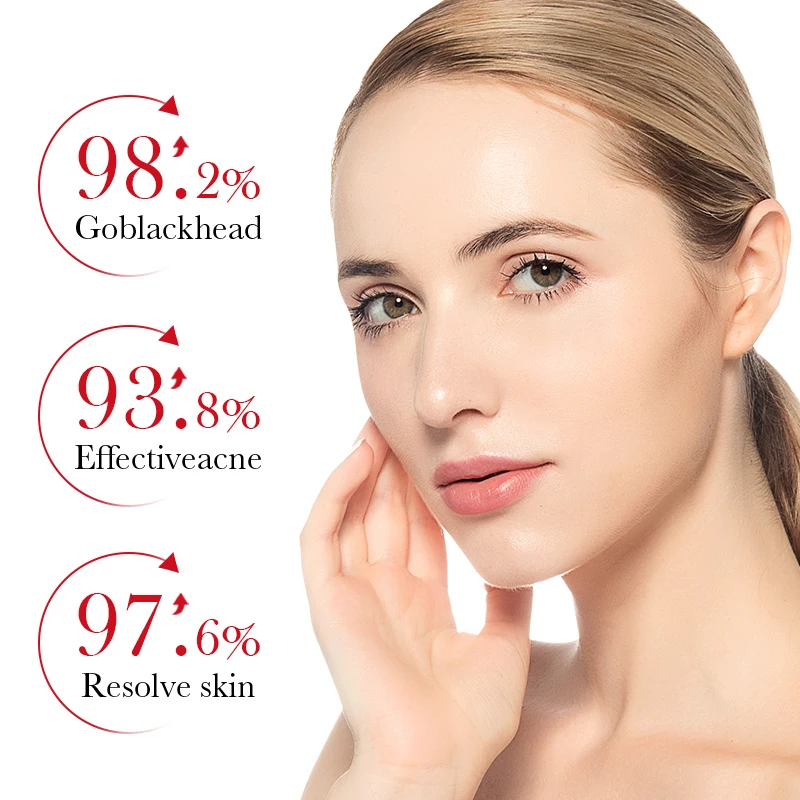 حمض الساليسيليك كريم وجه لطيف كريم إزالة حب الشباب...