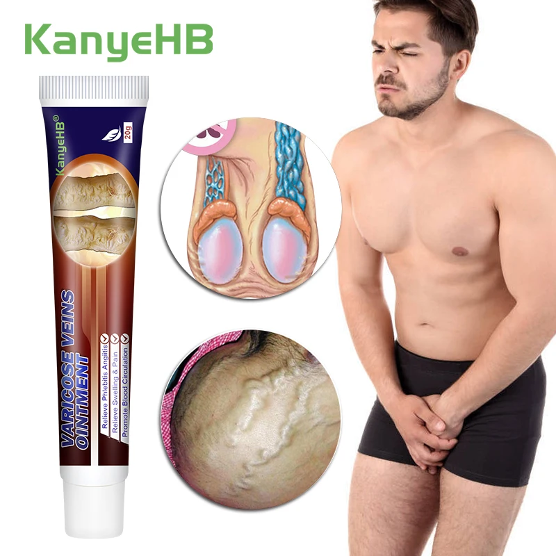 Men's Varicose Vein Ointment 1pcs Groin Pain Varicocele Cream Scrotum Swelling And Pain Improve Decreased Sexual Function G010 pain relief cream skin care ointment