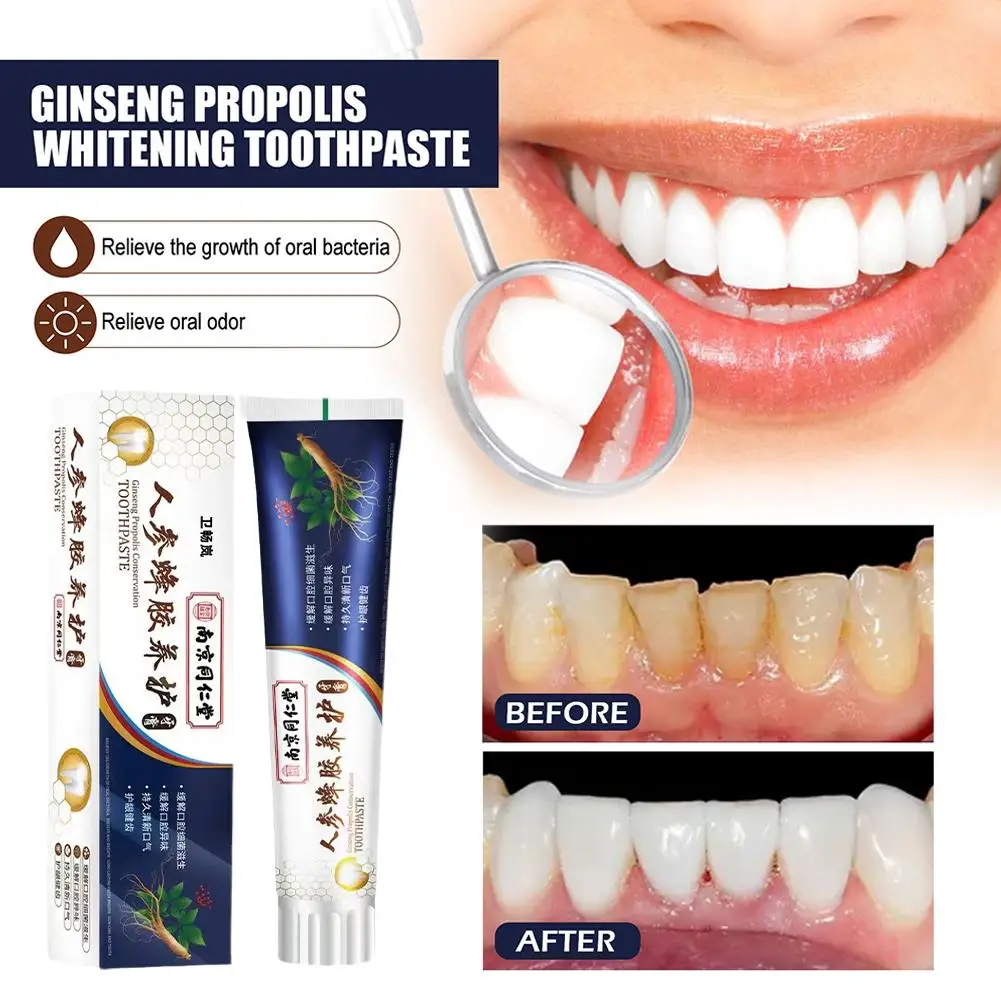 

120g Tooth Decay Whitening Toothpaste To Tooth Stains Remove Whiten Plaques Protect Clean Teeth Deep Strengthens Z8X3