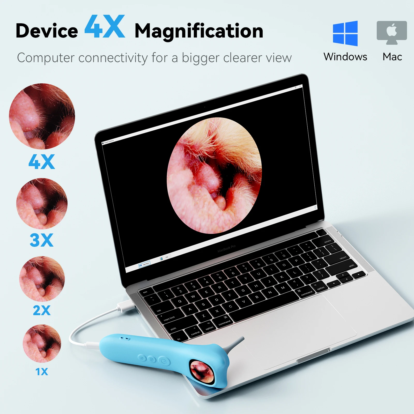 Q12-B 동물 귀 카메라 실시간 보기 최대 128GB 영상 설정 귀 카메라 사진 비디오 고화질 이경경