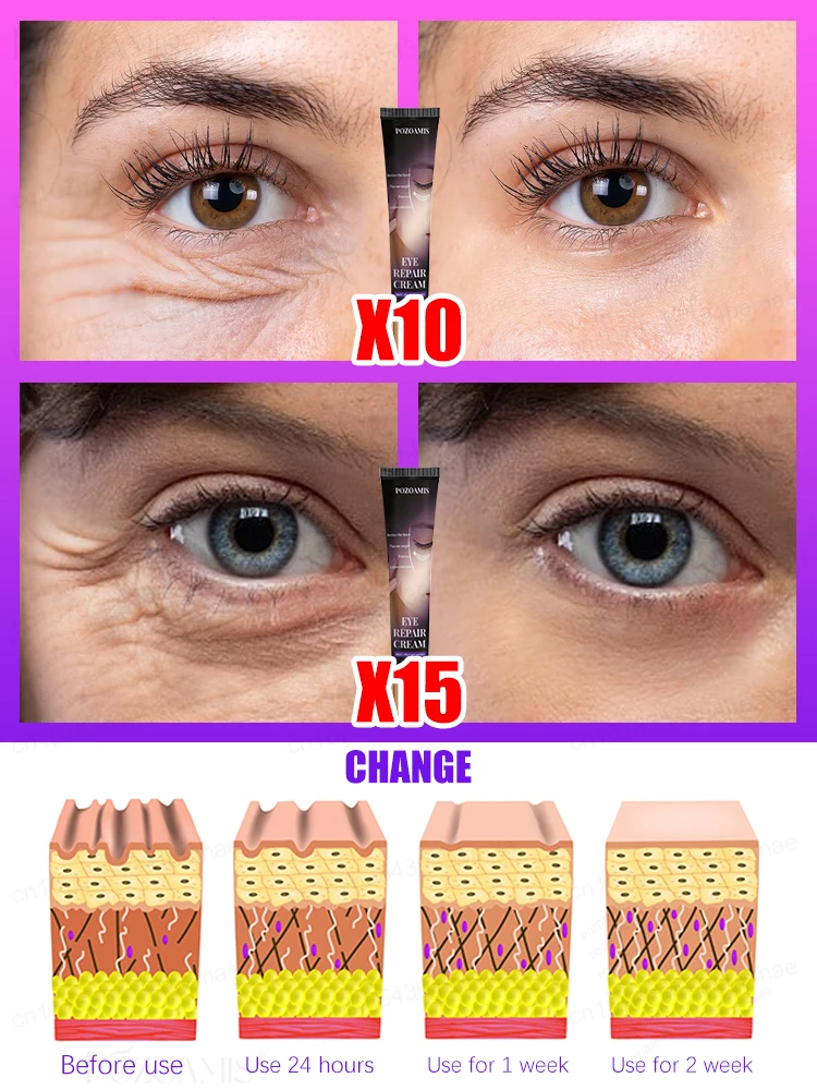 The most effective eye cream eliminates wrinkles eye bags dark circles tightens skin brightens skin in 7 days beauty enhancement product