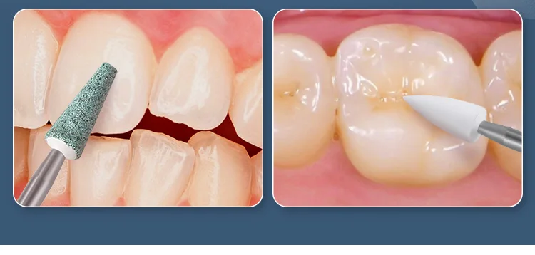 AZDENT Dental Poliersteine Weiß FG 1,6 mm zur Verwendung in Hochgeschwindigkeits-Handstücken und Reibungsgriff-Niedriggeschwindigkeits-Winkelstückköpfen – Detail 6