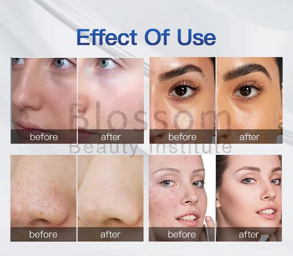 آلة التجميل