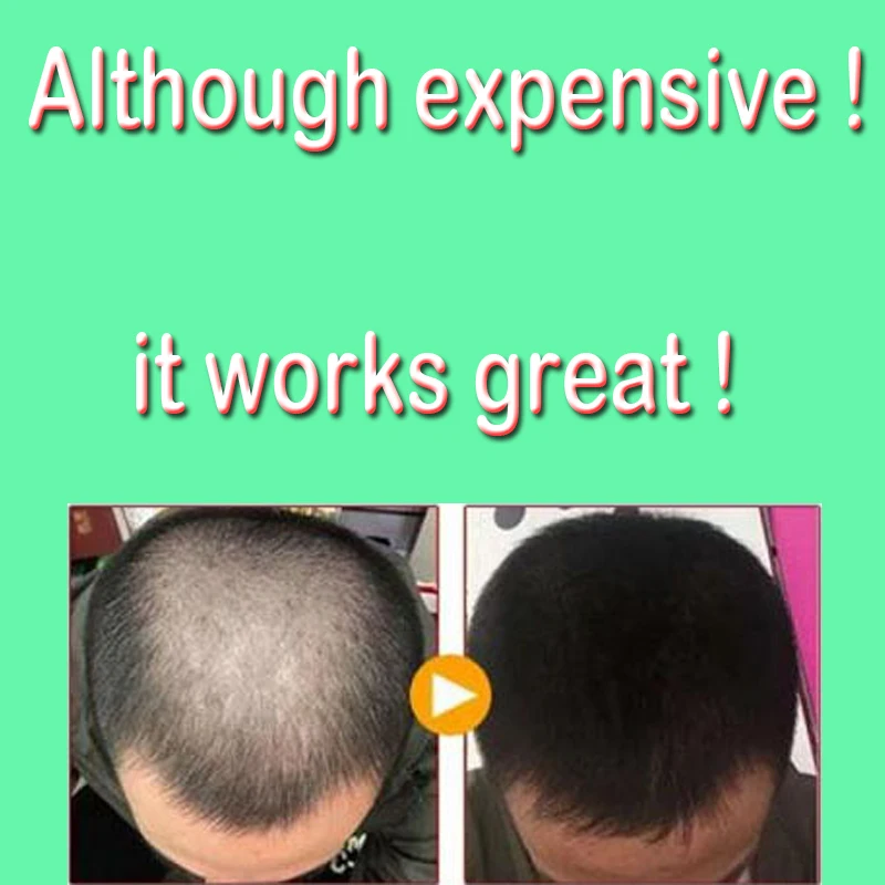 20ml Hair Care Hair Growth Essential Oils Essence Original 100% Hair Loss Liquid Health Care Beauty Dense Serum free shipping hair growth serum anti hair loss strengthen dense hair treat hereditary postpartum seborrheic alopecia scalp massage