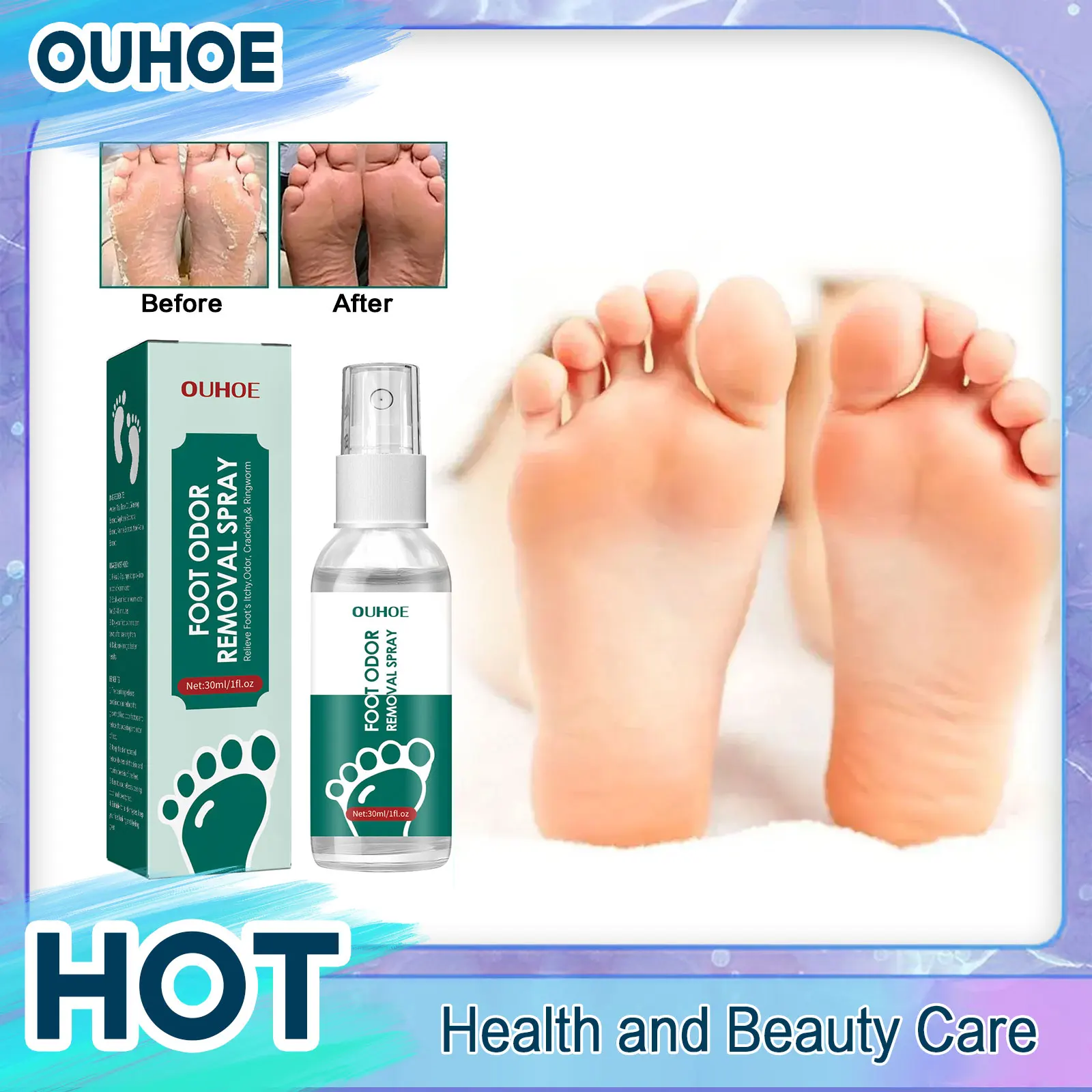 

Foot Odor Spray Anti Fungal Onychomyco Sterilization Itch Sweat Odor Remover Crack Chapped Removal Athletes Feet Deodorant Spray