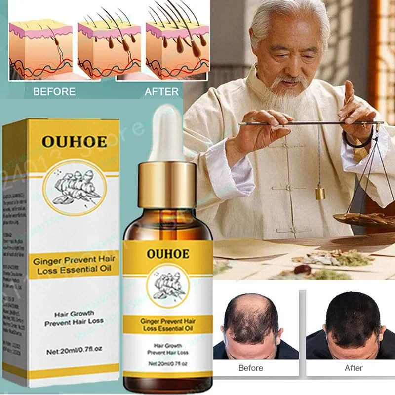 

Ginger Hair Growth Spray Serum For Anti Hair Loss Essential Oil Products Fast Treatment Prevent Hair Thinning Dry Frizzy Repair