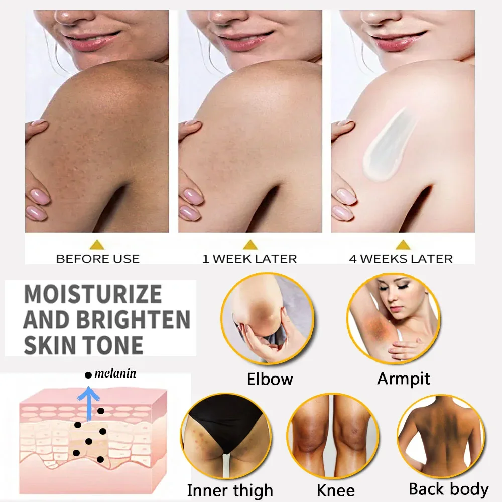 Body Whitening Cream Remove Thigh Inner Joint Dark Melanin Knee Bleach Private Part Whiten Lighten Moisturize Brighten Body Care 4