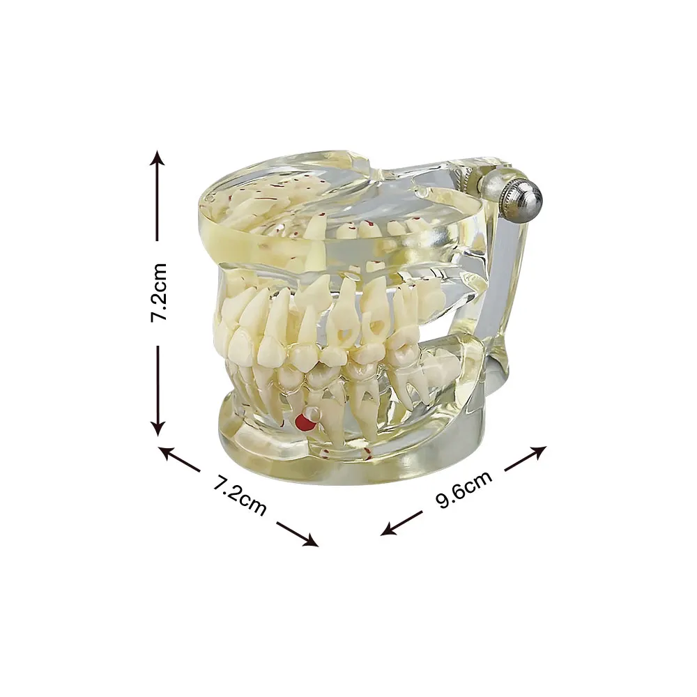 modèle dentaire pour dents primaires en étude de dentiste avec outils de démonstration fuchsia