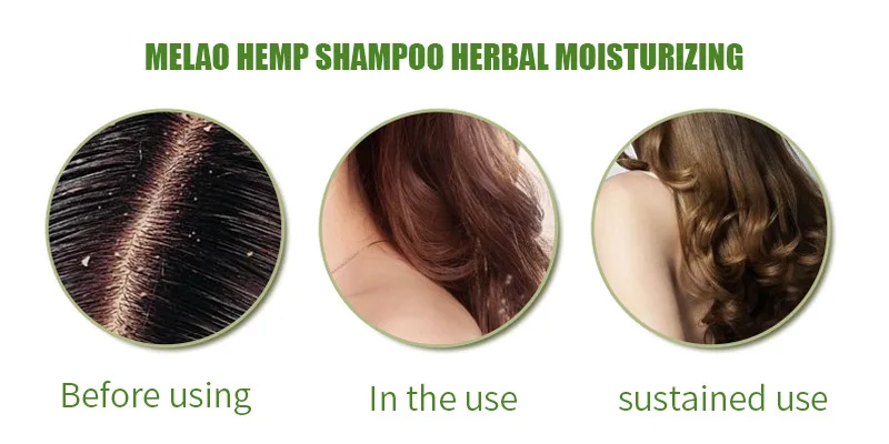 Hidratação e Alisamento Shampoo de Cânhamo para Reparar Fortalecer as Raízes do Cabelo Nutrir o Crescimento do Cabelo do Couro Cabelos Frisados Danificados Cabeludo 7 Computers & Electronics