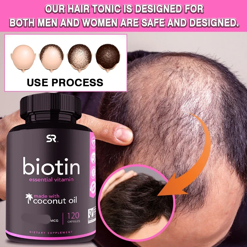 

Dietary Supplement To Enhance Hair, Nail Growth, Improve Skin Texture, High Potency Biotin and Organic Coconut Oil Capsules