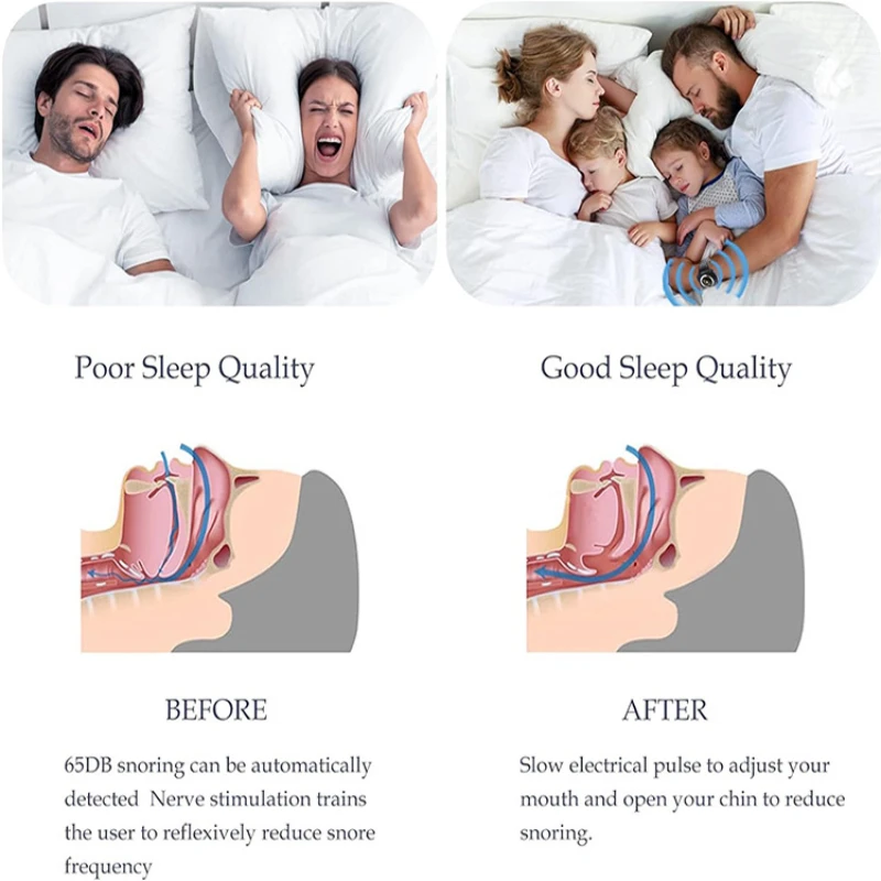 Professional Electronic Auto Anti Snore Wristband New Cessation Cure Solution Sleeping Night Guard Aide Snore Go Away Biosensor