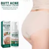 Butt Acne Treatmen Cream Buttock Pimple Removal Clearing Buttock Thigh Acne Moisturize Smoothing Nourish Body Acne Repair Cream 1