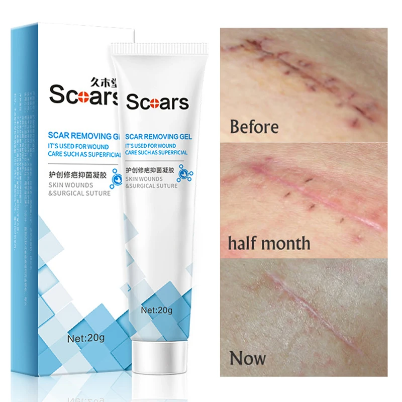 Herbal Scar Removal Cream Gel Repairing Stretch Marks Burn Surgical