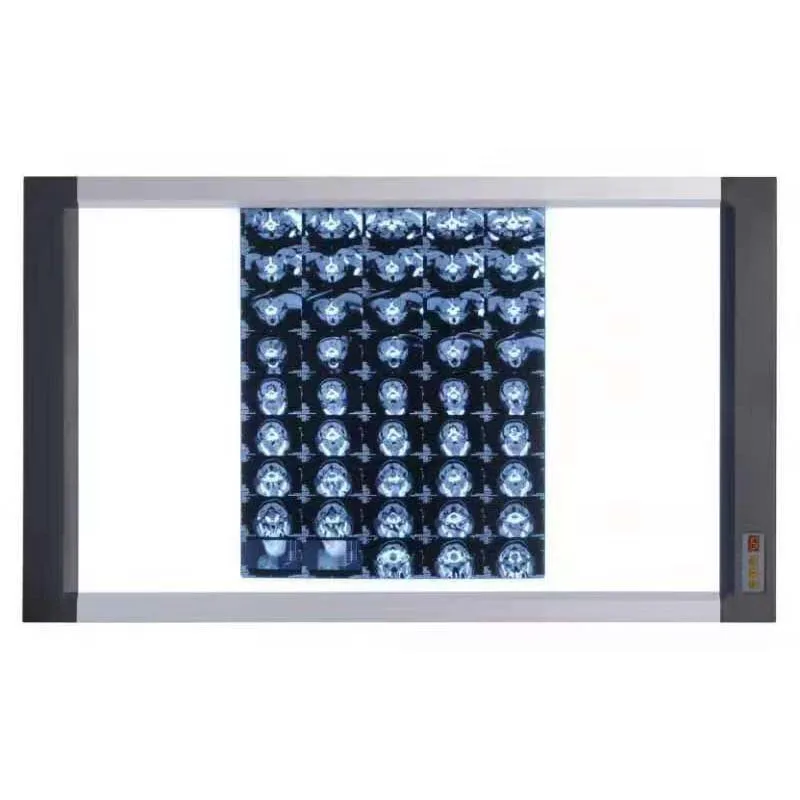

High Quality Led Professional View X Ray Film Medical Hospital Scanner Box Negatoscope X-ray Film Viewer