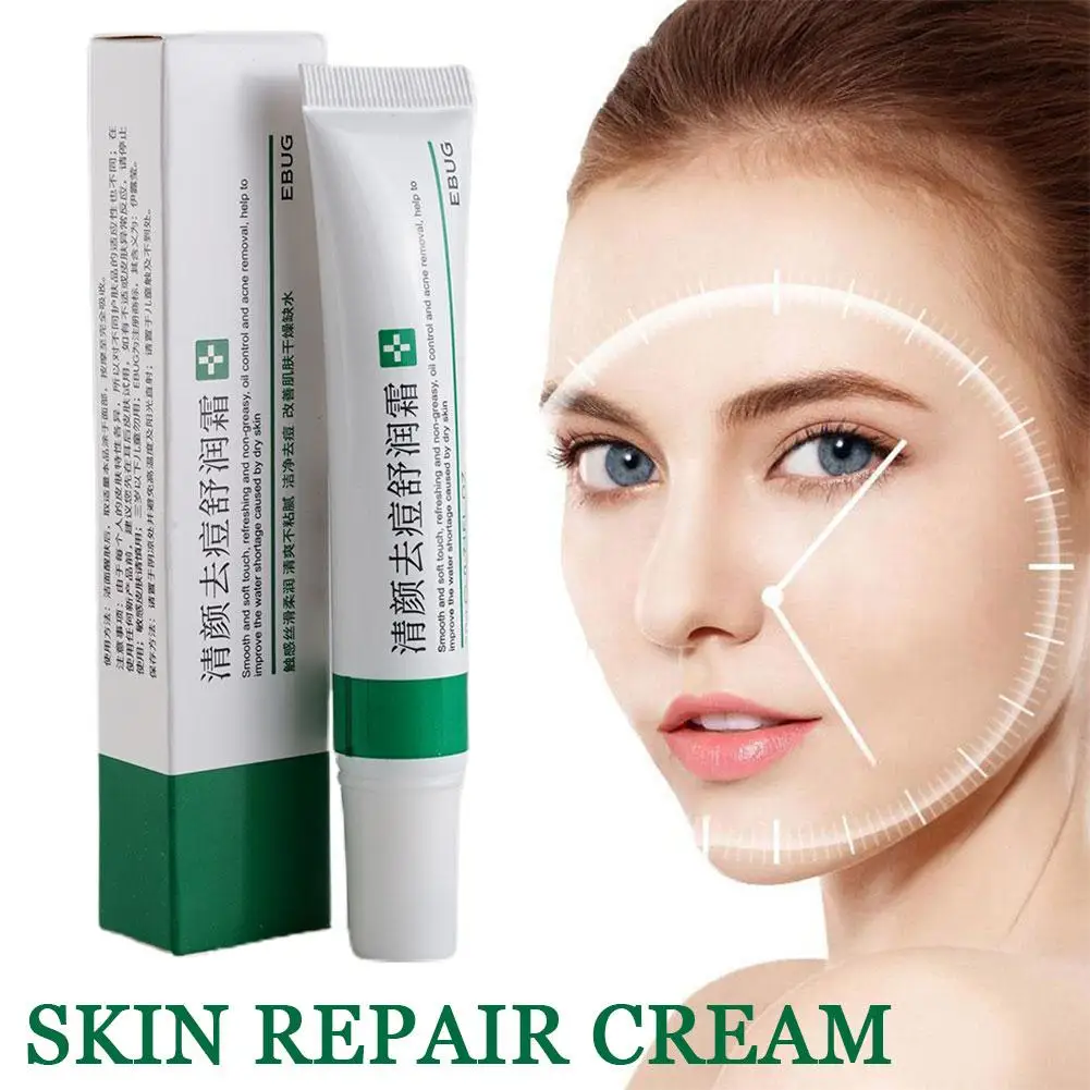 Acne Removal Cream Freckle Cream Shrink Pores Whitening Moisturizing