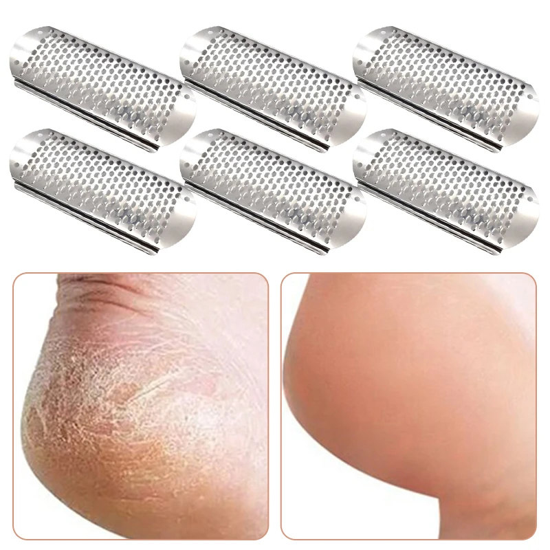 6PCS Fuß Datei Kallus Entferner Werkzeug für Abgestorbene Haut Entfernung Hause Pediküre Werkzeuge Fuß Raspel Kallus Entferner Füße Heels reibe Datei – Detail 2