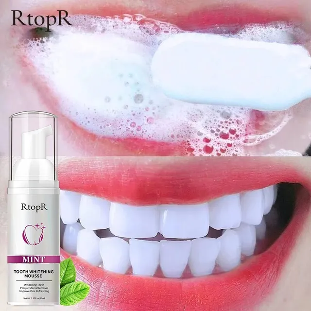 RtopR Teeth Cleansing Whitening Mousse Removes Stains  2