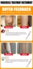 Varicose Vein Lampshade Therapy Effective Relief Of Dilated Vasculitis In The Legs Phlebitis Improved Blood Circulation New 5