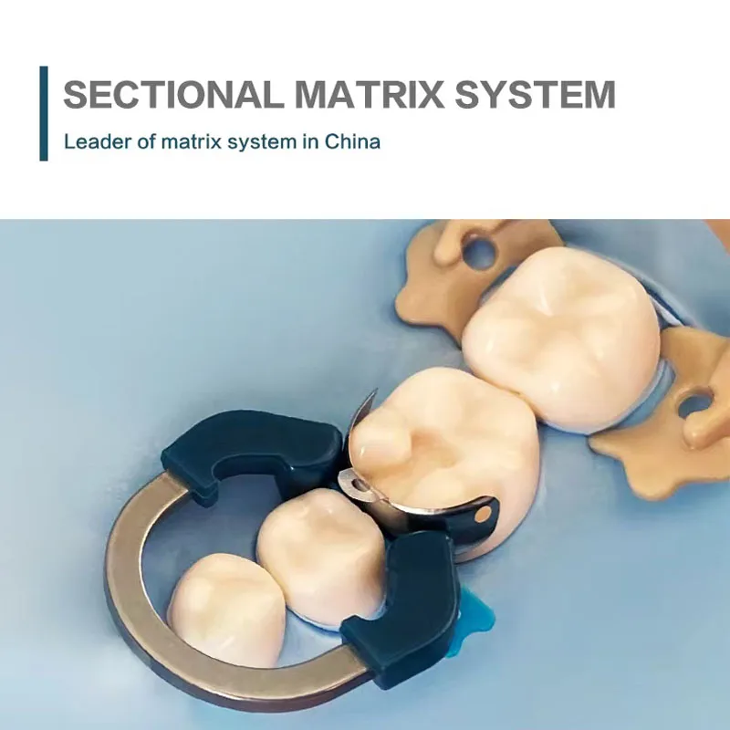 Dental Matrix Bands Sectional Contoured Matrix System Metal Matrices Clamp Nickel Titanium Clamping Ring Dentist Tools dental matrix system