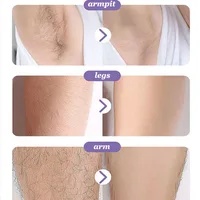 Nano Crystal Epilator Stone Physical Hair Remover Eraser Painless Epilator Depilatory Gum Ladies Women Man Can Washable Clean - Image 5