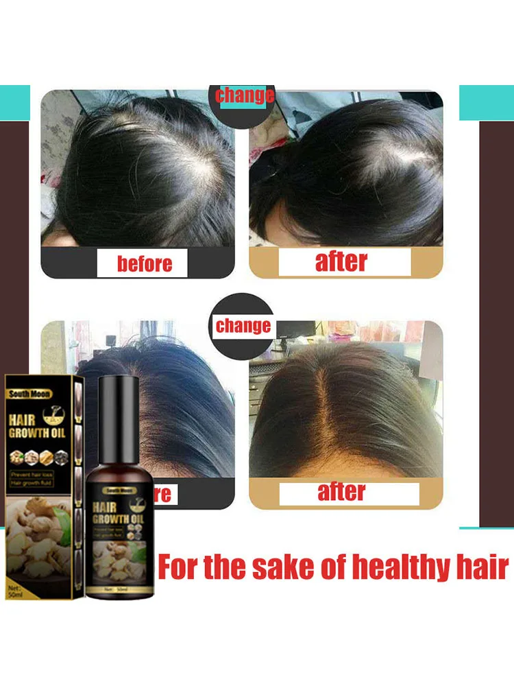 

Anti hair loss spray anti hair loss hair nutrition growth agent essence promotes hair growth.Keep your hair healthy