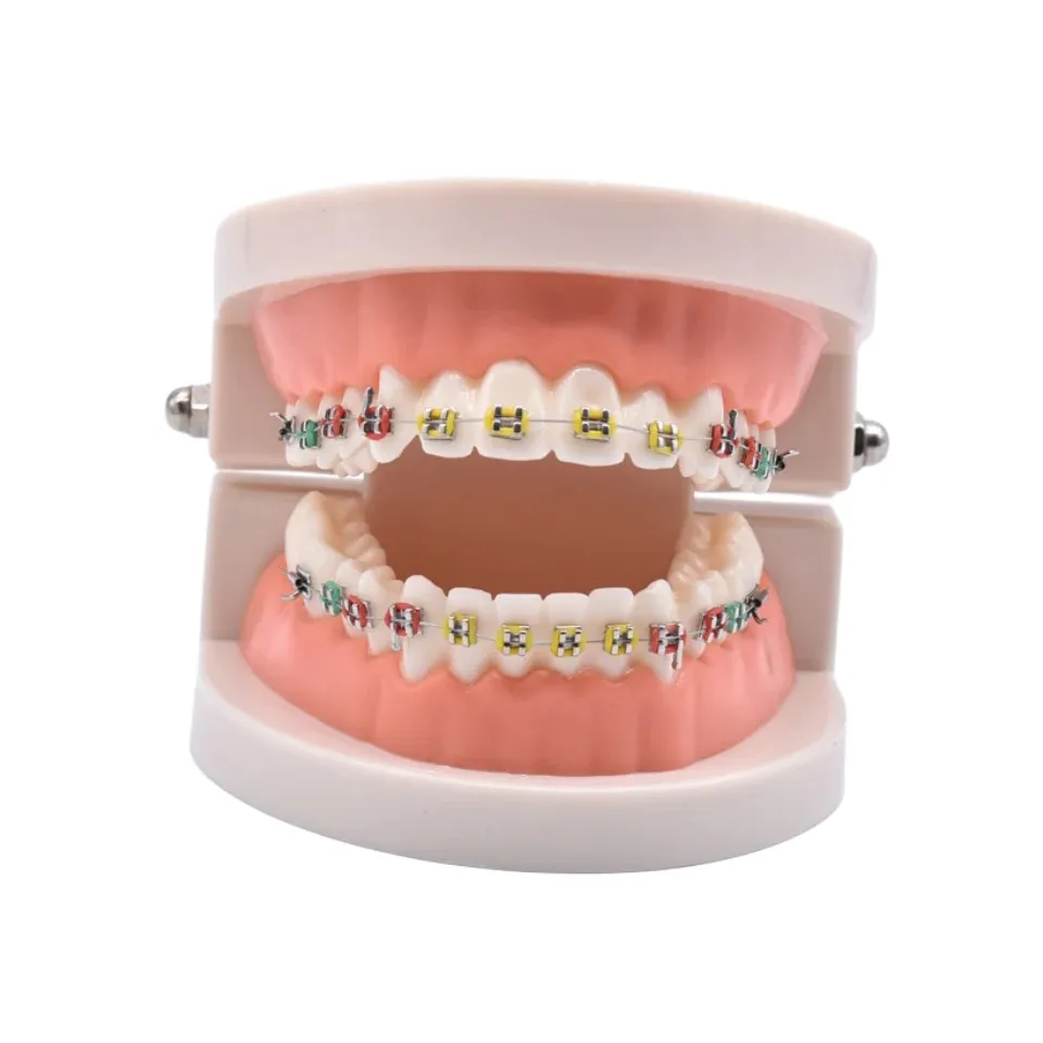 Dental Orthodontic Treatment Teeth Model With Bracket Arch Wire Buccal Tube Ligature Ties Dentist Lab Tooth Model Teaching Tools 3