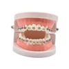 Dental Orthodontic Treatment Teeth Model With Bracket Arch Wire Buccal Tube Ligature Ties Dentist Lab Tooth Model Teaching Tools 3