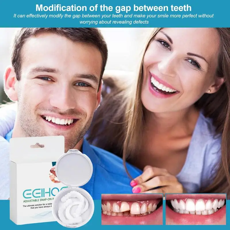 1 Pair Resin Teeth Veneers Repair Kit To Cover Imperfect Teeth Adjustable Snap On Dentures For Temporary Teeth Confident Smile