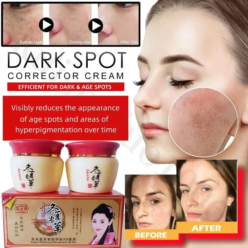 Day Night Cream Remove Dark Spots Melanin Black Dots Melasma Remover Anti Pigmentation Brighten Whitening Freckle Cream