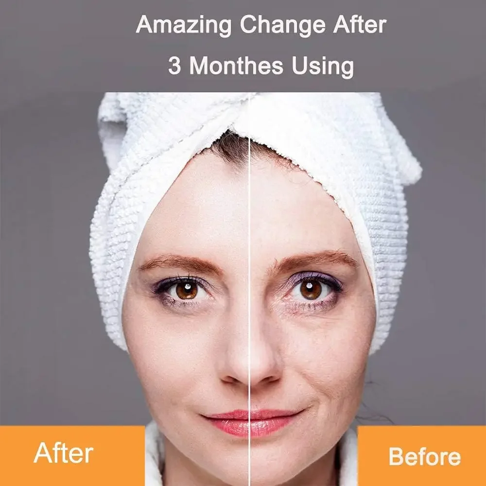 Electric Face Massager 3D Roller Facial Lifting Cleansing V-face Moisturizer Essence Absorption Instrument Skin Care Device 4