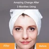 Electric Face Massager 3D Roller Facial Lifting Cleansing V-face Moisturizer Essence Absorption Instrument Skin Care Device 4