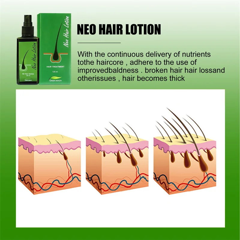 Orginal Natural Thailand Neo Hair Lotion Hair Care Oil Hair Grow Serum Essential Hair Loss Treatment Product Hair Growth Sprays