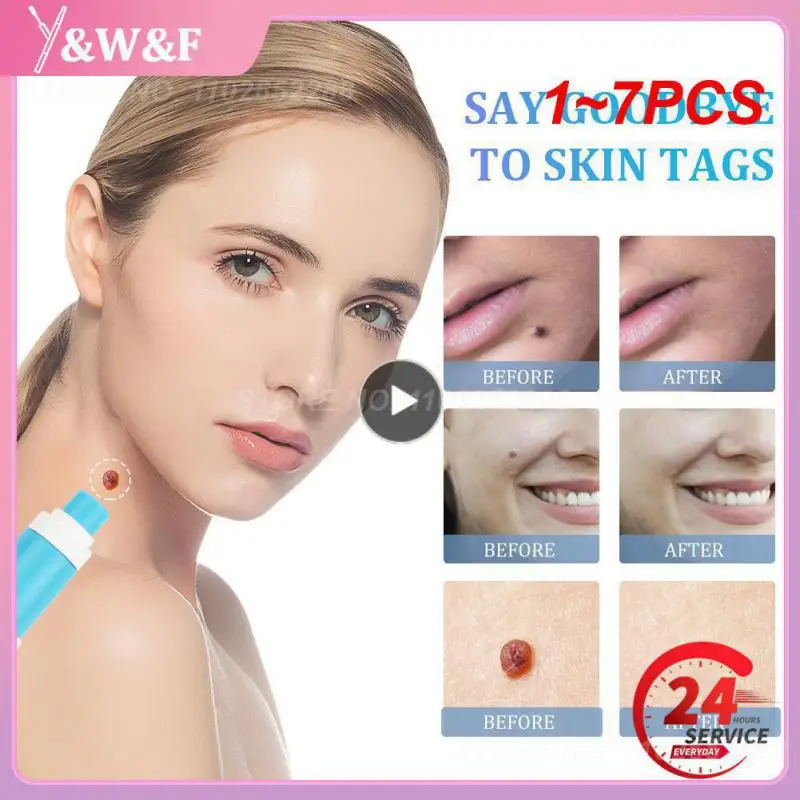 

1-7 шт., набор для удаления родинок и кожи