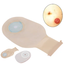 10Pcs Disposable Colostomy Bag Soft Skin-Friendly Colostomy Pouch Bag Available Types Closing Type Open Type Comfortable Nursing