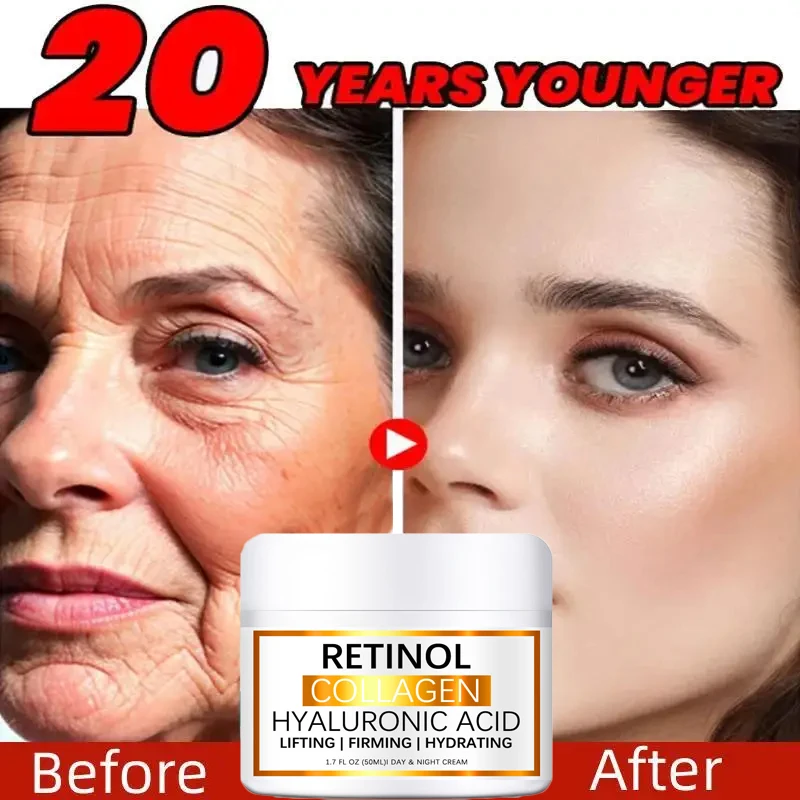 

Retinol Wrinkle Removing Cream Lift Firm Fade Fine Lines Collagen Anti-aging Moisturizing Brightening Skin Care Korean Cosmetics