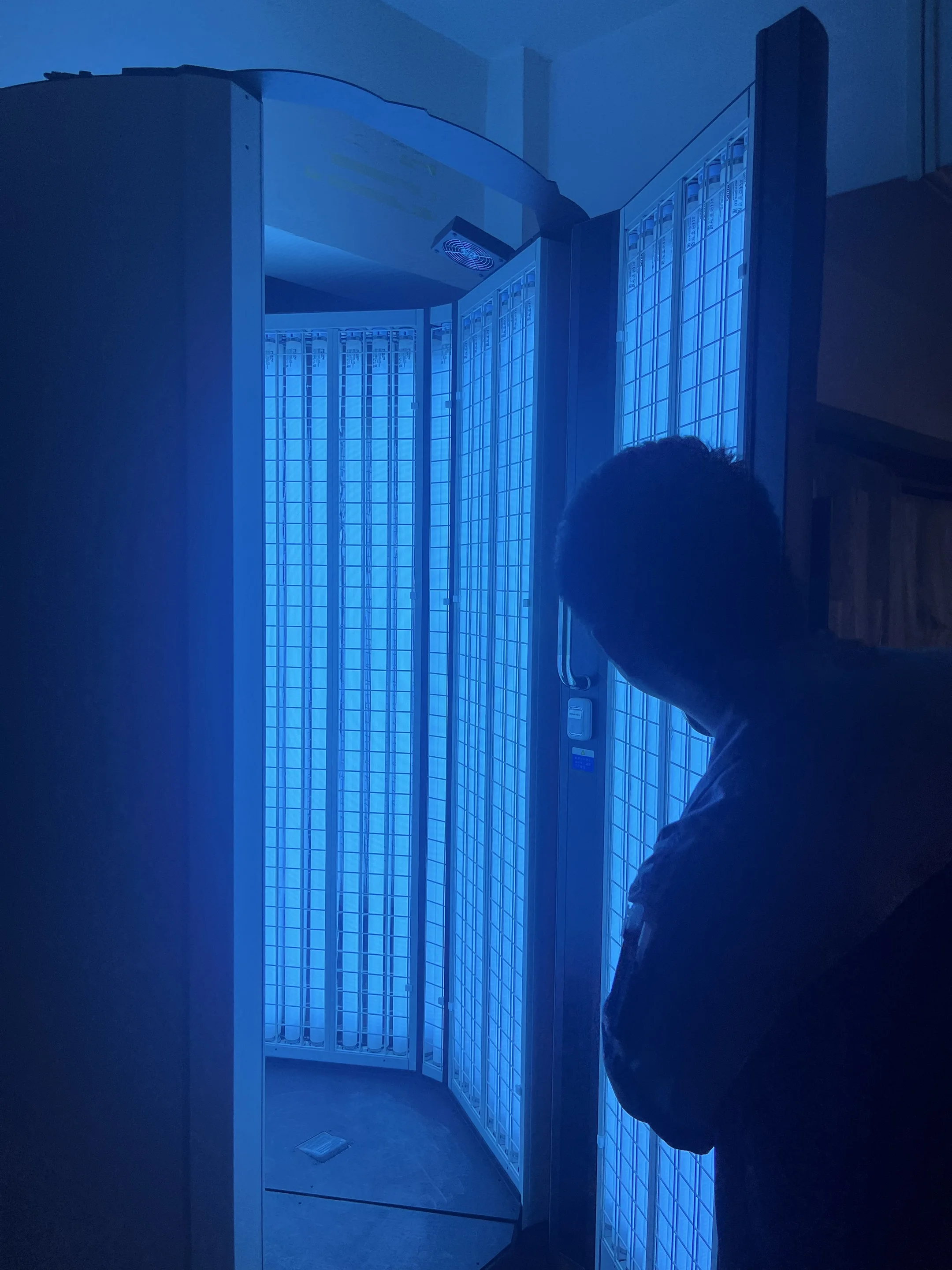 Рисунок 6 - Зернистость, УФ-кабина 311нм