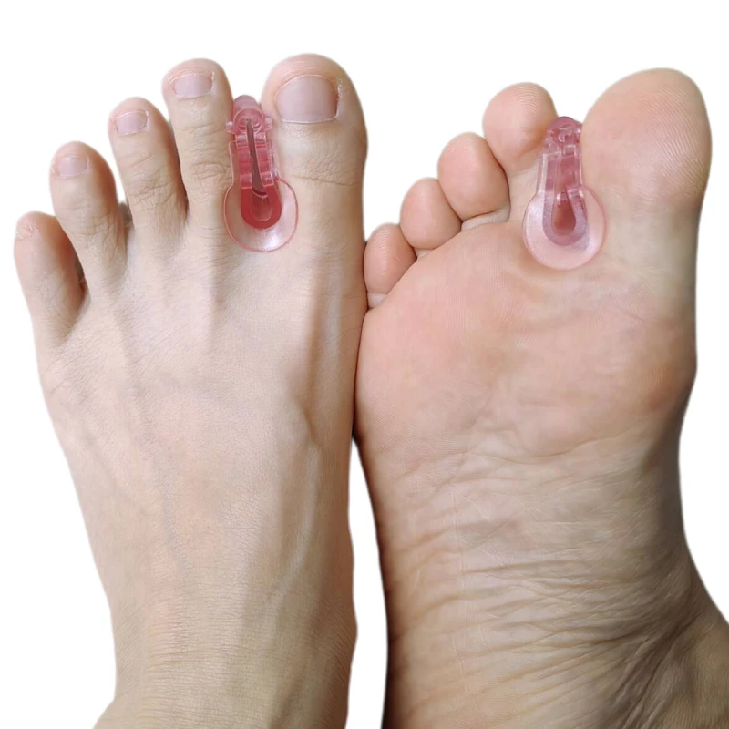 7 Paia Separatori Per Dita Dell'Alluce Valgo Gel Di Silicone Hammer Toe Piedi Cura Correttore Dell'Alluce Raddrizzatore Sollievo Dal Dolore Del Piede 