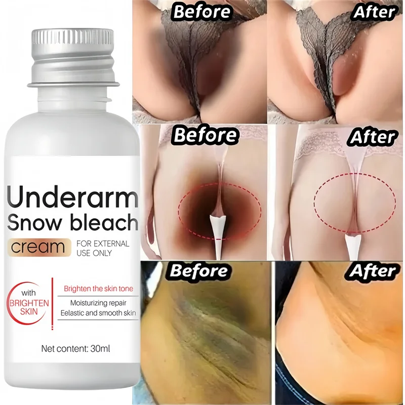 Whitening Cream Private Parts Underarm Bleaching Serum Whiten Butt Knee Brighten Inner Thigh Intimate Parts Dark Remove Melanin whitening body cream whitening cream brightening cream whitening serum brightening body cream