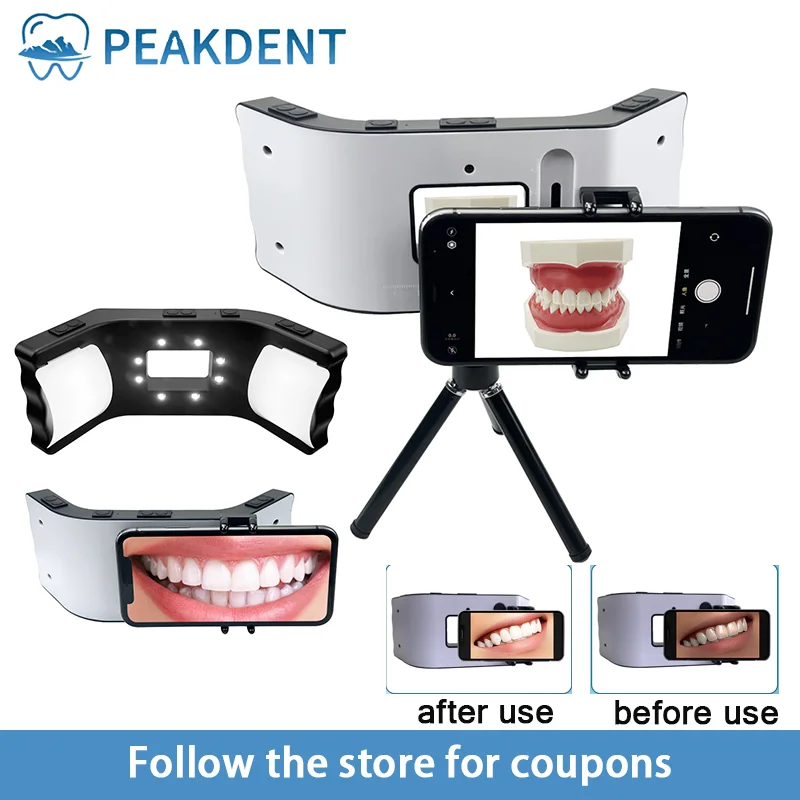 Dental Photography Oral Filling Lamp Flash Light Supply Bright Environment Photo Macro Intraoral Light Dentistry With Bracket