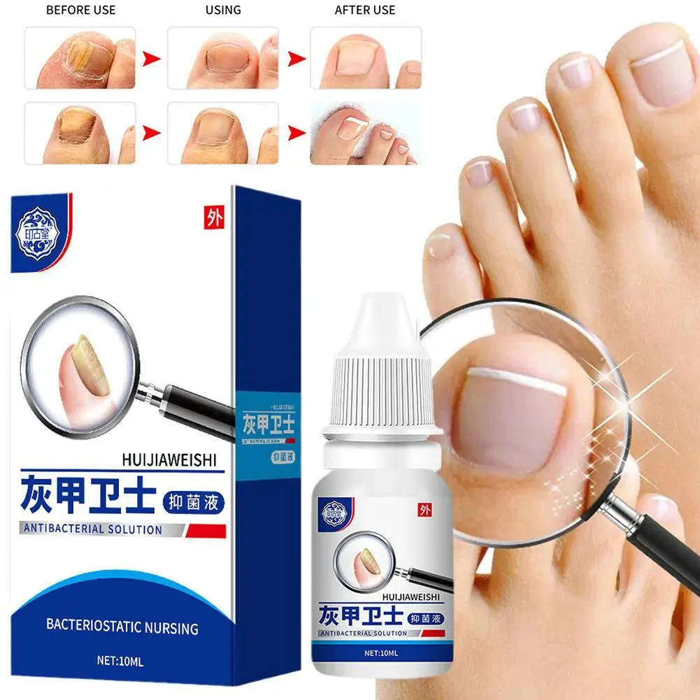 

10ml Nail Fungal Treatment Serum Anti Infection Onychomycosis Paronychia Essence Toes Fungus Hand Foot Repair Nail Care Products