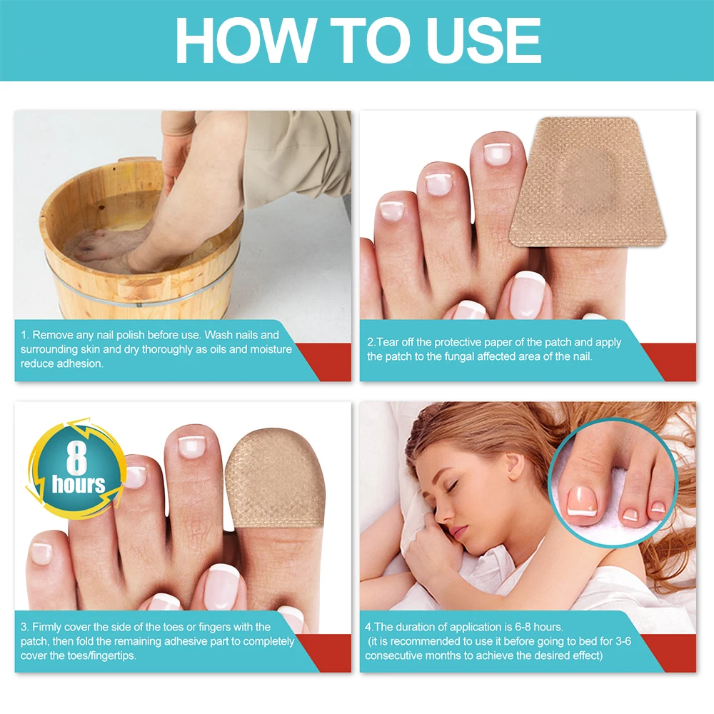 Nail Treatment Patch Anti Fungal Nail Correction Stickers Ingrown Toenail Care Paronychia Anti Infection Repair Patches foot care patches nail problem solving toenail fungus patch nail repair