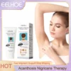 Body Whitening Cream Bleach Dark Knuckle Armpits Elbow Knee Legs Nourishing Brighten Skin Tone Exfoliate Lighten Melanin Lotion 1